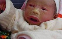 第三代试管选好性别准确率高吗？长沙地区有哪些私立的机构可以做试管技术？