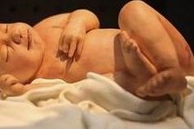 染色体易位在江西省妇幼保健院可以做三代试管吗？染色体平衡易位还能生健康的宝宝吗？